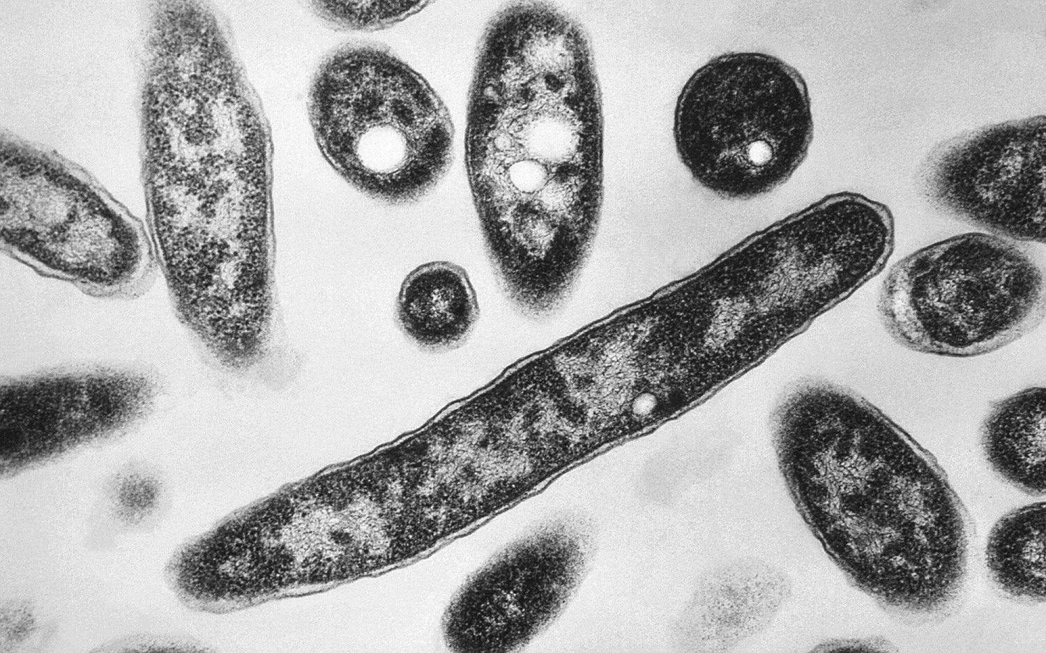 Six die, 111 infected in NYC Legionnaires’ outbreak